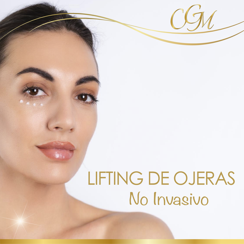 LIFTING  DE OJERAS no invasivo - 6 Sesiones