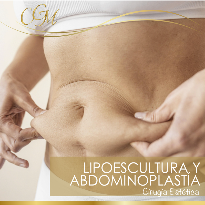 LIPOESCULTURA Y ABDOMINOPLASTIA