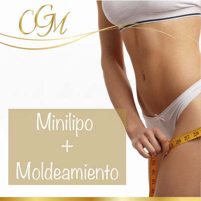 TRATAMIENTO REDUCTIVO CON CARBOXITERAPIA + L-CARNITINA Clnica Globalmedic TRATAMIENTO REDUCTIVO CON CARBOXITERAPIA + L-CARNITINA Clnica Globalmedic