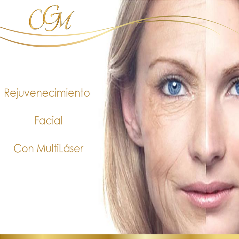 Rejuvenecimiento Facial con Multi-Láser